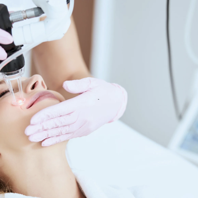 Best Laser Resurfacing Near Tysons VA